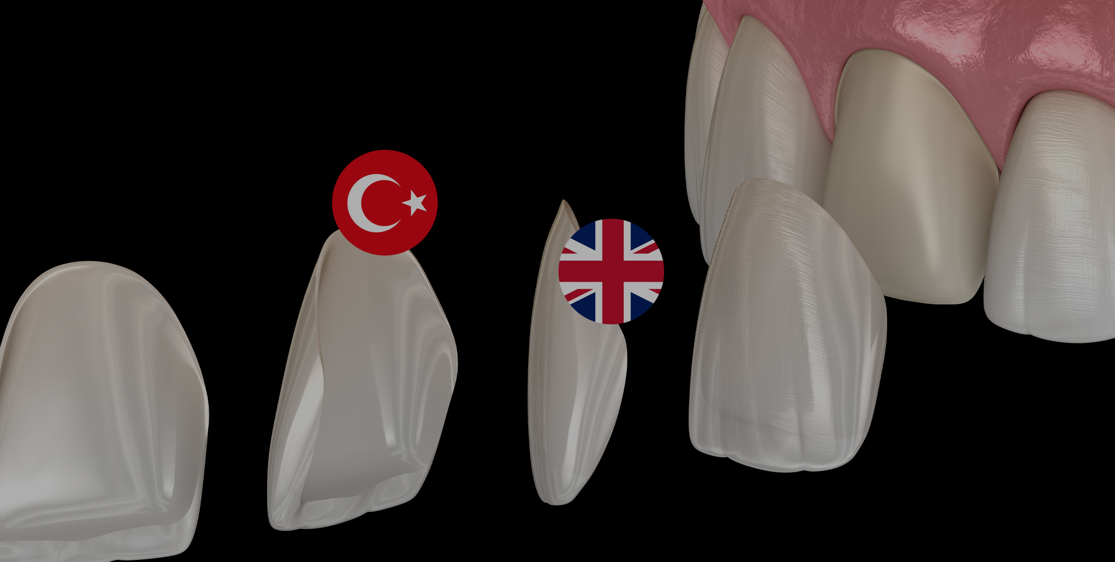 How to know where to get your veneers: Turkey Or England